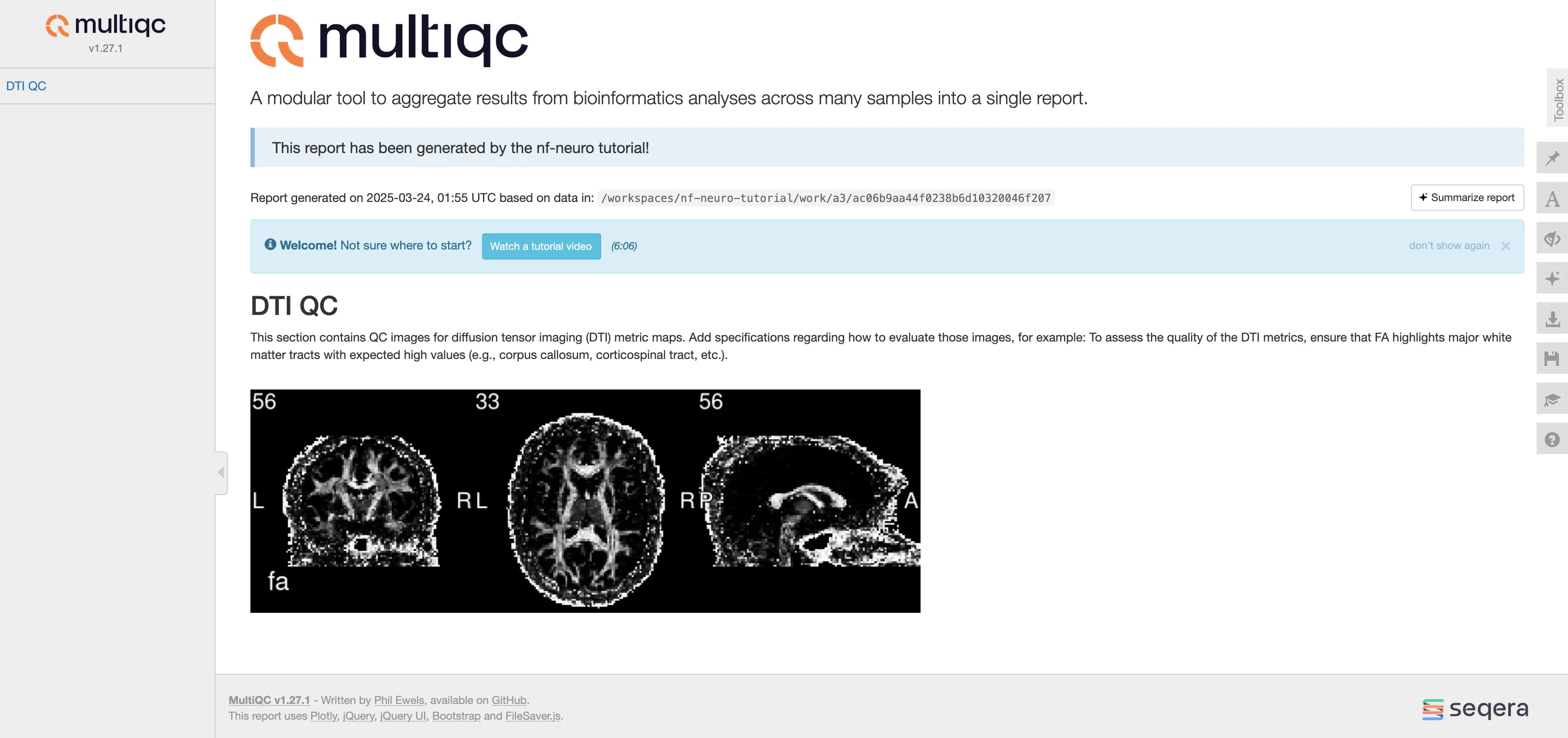 MultiQC Clean Report