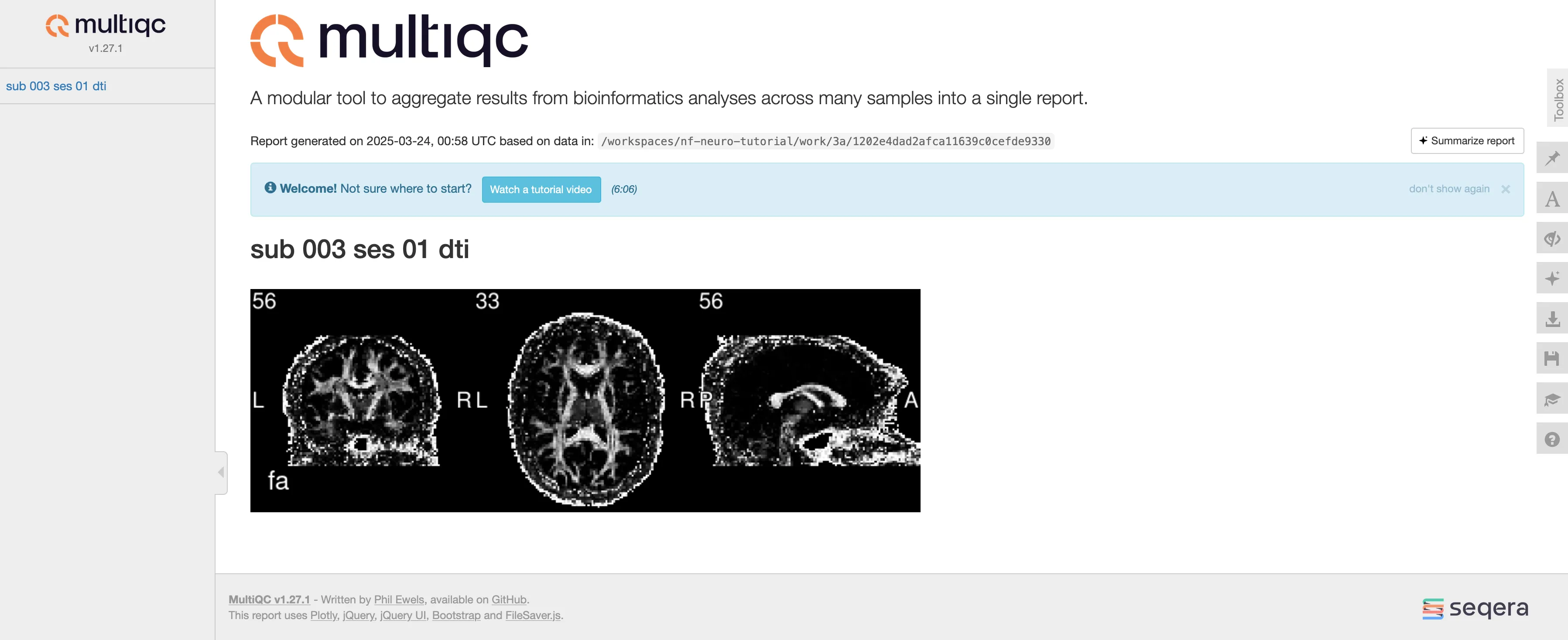 Raw MultiQC Report